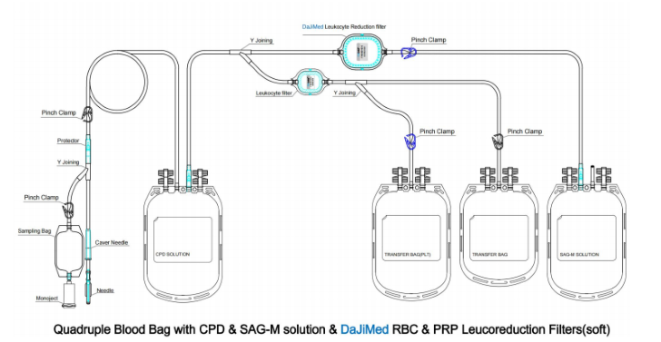Blood bag with RBCand PRP in-line leucocyte reduction filter